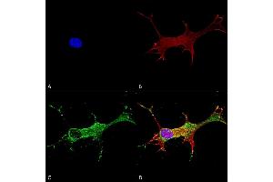 Immunocytochemistry/Immunofluorescence analysis using Mouse Anti-Notch1 Monoclonal Antibody, Clone S253-32 (ABIN2483203).
