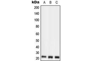 Western blot analysis of RKIP expression in HepG2 (A), SP2/0 (B), H9C2 (C) whole cell lysates. (PEBP1 anticorps  (Center))