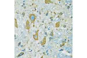 Immunohistochemistry of paraffin-embedded mouse spinal cord using RPS7 antibody.