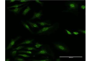 Immunofluorescence of monoclonal antibody to RPS29 on HeLa cell. (RPS29 anticorps  (AA 1-56))