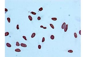Immunocytochemistry analysis of ABIN7127271 diluted at 1:100 and staining in Hela cells performed on a Leica BondTM system.