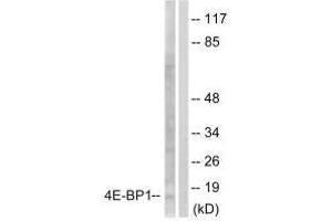 Western blot analysis of extracts from Jurkat cells, treated with Insulin (0. (eIF4EBP1 anticorps  (Ser65))