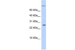 ARID5A antibody used at 0. (ARID5A anticorps  (N-Term))