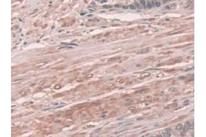 Detection of NOX1 in Human Prostate Tissue using Polyclonal Antibody to Nicotinamide Adenine Dinucleotide Phosphate Oxidase 1 (NOX1) (NOX1 anticorps  (AA 235-488))