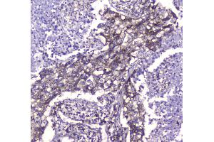IHC analysis of CLPP using anti-CLPP antibody .