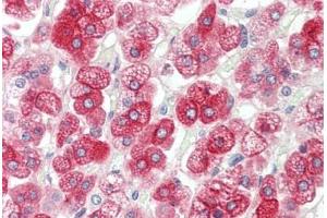 Human Adrenal: Formalin-Fixed, Paraffin-Embedded (FFPE)