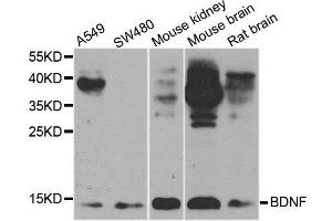 Western blot analysis of extracts of various cell lines, using BDNF antibody. (BDNF anticorps  (AA 20-247))