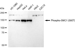 Western blotting analysis using Phospho-SMC1 (S957) antibody (ABIN7800447).