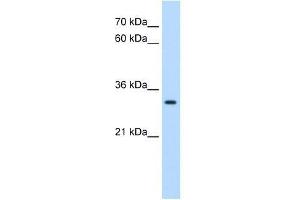 DBX2 antibody used at 0. (DBX2 anticorps  (N-Term))