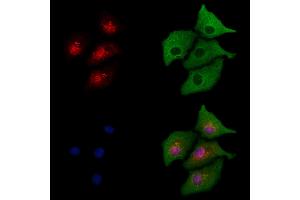 ABIN6264613 and ABIN6277733 staining  cells by IF/ICC. (RAD21 anticorps  (C-Term))