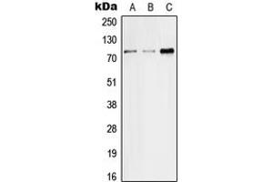 Western blot analysis of SGLT2 expression in HeLa (A), SP2/0 (B), H9C2 (C) whole cell lysates. (SLC5A2 anticorps  (Center))