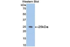 Western Blotting (WB) image for anti-Matrix Metallopeptidase 11 (Stromelysin 3) (MMP11) (AA 287-491) antibody (ABIN1078305) (MMP11 anticorps  (AA 287-491))