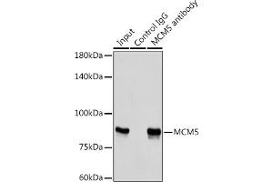 Immunoprecipitation analysis of 300 μg extracts of HeLa cells using 3 μg MCM5 antibody (ABIN6132075, ABIN6143645, ABIN6143647 and ABIN6221204). (MCM5 anticorps  (AA 1-230))