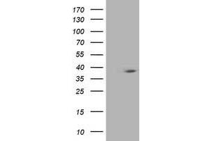 Western Blotting (WB) image for anti-HSPA Binding Protein, Cytoplasmic Cochaperone 1 (HSPBP1) antibody (ABIN1498761) (HSPBP1 anticorps)