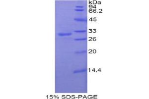 SDS-PAGE analysis of Rat PNMA2 Protein. (PNMA2 Protéine)