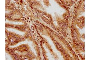 IHC image of ABIN7155766 diluted at 1:400 and staining in paraffin-embedded human prostate tissue performed on a Leica BondTM system.