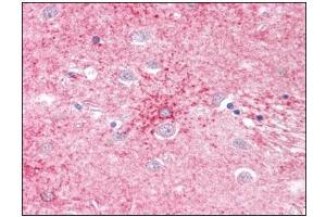 Human Brain, Basal Ganglia: Formalin-Fixed, Paraffin-Embedded (FFPE) (SLC1A4 anticorps)
