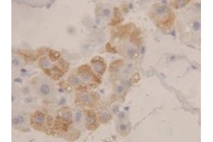 Detection of HEXb in Human Liver Tissue using Polyclonal Antibody to Hexosaminidase B Beta (HEXb) (HEXB anticorps  (AA 315-456))