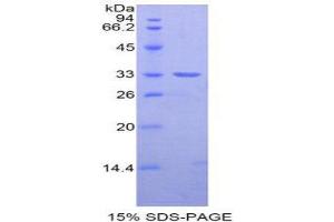 SDS-PAGE (SDS) image for Nexilin (NEXN) (AA 214-455) protein (His tag) (ABIN2126087) (NEXN Protein (AA 214-455) (His tag))