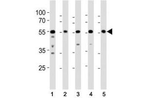 Western blot analysis of lysate from (1) A431, (2) RD, (3) mouse NIH3T3, (4) mouse C2C12, and (5) rat PC-12 cell line using Src antibody at 1:1000.