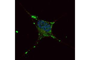 Fluorescent confocal image of SY5Y cells stained with ELP2 antibody. (ELP2 anticorps  (C-Term))