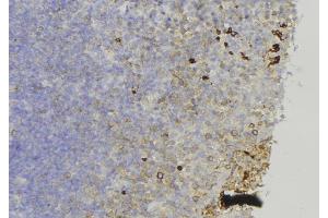 ABIN6274003 at 1/100 staining Human lymph node tissue by IHC-P.