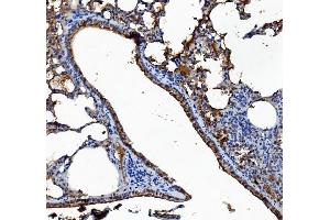 IHC analysis of Liver Carboxylesterase 1/CES1 using anti-Liver Carboxylesterase 1/CES1 antibody (ABIN7602719). (CES1 anticorps  (AA 99-206))