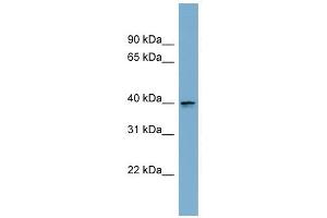 ASPHD2 antibody used at 1 ug/ml to detect target protein. (ASPHD2 anticorps  (Middle Region))