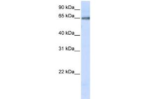 WB Suggested Anti-DCLRE1C Antibody Titration:  0. (DCLRE1C anticorps  (C-Term))