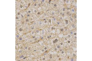 Immunohistochemistry (IHC) image for anti-Potassium Voltage-Gated Channel, KQT-Like Subfamily, Member 1 (KCNQ1) (AA 250-549) antibody (ABIN3023121)