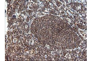 Image no. 7 for anti-tRNA Methyltransferase 2 Homolog A (TRMT2A) antibody (ABIN1501516)