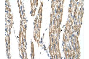 Immunohistochemistry (IHC) image for anti-Alanine Aminotransferase (ALT) (N-Term) antibody (ABIN2782331)