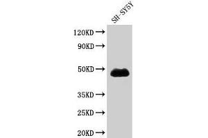 Western Blot Positive WB detected in: SH-SY5Y whole cell lysate All lanes: NADK antibody at 1. (NADK anticorps  (AA 1-300))