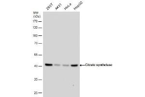WB Image Citrate synthetase antibody detects Citrate synthetase protein by western blot analysis.