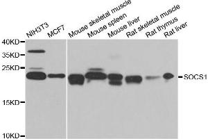 Western blot analysis of extracts of various cell lines, using SOCS1 antibody. (SOCS1 anticorps)