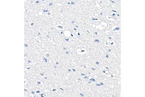 Immunohistochemistry of paraffin-embedded Human brain (negative control sample) using δ-Catenin/p120 Catenin antibody (ABIN7266144) at dilution of 1:500 (40x lens). (CTNND1 anticorps)