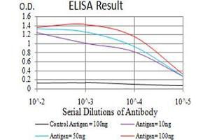 Black line: Control Antigen (100 ng);Purple line: Antigen (10ng); Blue line: Antigen (50 ng); Red line:Antigen (100 ng) (TTF1 anticorps  (AA 1-150))