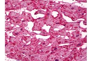 Anti-FABP3 antibody IHC of human heart.