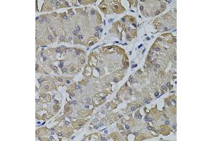 Immunohistochemistry of paraffin-embedded human stomach using TRPC3 antibody (ABIN5995383) (40x lens). (TRPC3 anticorps)