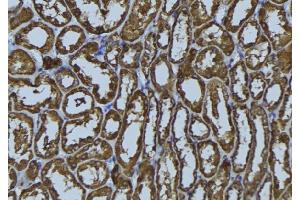 ABIN6272406 at 1/100 staining Rat kidney tissue by IHC-P. (RAB34 anticorps  (Internal Region))
