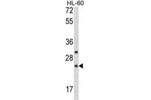 Western blot analysis of RGS1 Antibody (N-term) in HL-60 cell line lysates (35ug/lane). (RGS1 anticorps  (N-Term))