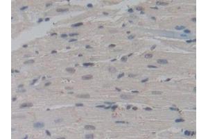 Detection of NUP85 in Mouse Heart Tissue using Polyclonal Antibody to Nucleoporin 85 (NUP85) (NUP85 anticorps  (AA 418-653))