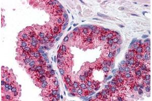 anti-Baculoviral IAP Repeat Containing 2 (BIRC2) (C-Term) antibody