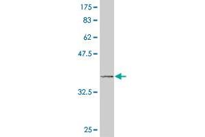 Western Blot detection against Immunogen (37.