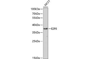 Western blot analysis of extracts of MCF-7 cells, using E2F6 antibody (ABIN1679632, ABIN1679631, ABIN5664137 and ABIN6219769) at 1:1000 dilution. (E2F6 anticorps  (AA 1-281))