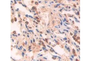 IHC-P analysis of Human Tissue, with DAB staining. (PSMA7 anticorps  (AA 3-211))