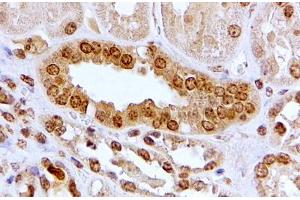 ABIN5539467 (2µg/ml) staining of paraffin embedded Human Kidney. (Aryl Hydrocarbon Receptor anticorps  (Internal Region))