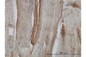 Immunoperoxidase of monoclonal antibody to CA3 on formalin-fixed paraffin-embedded human skeletal muscle.