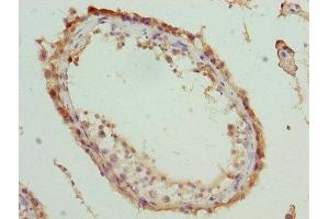 anti-Moloney Leukemia Virus 10 (MOV10) (AA 601-900) antibody