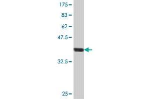 Western Blot detection against Immunogen (38.